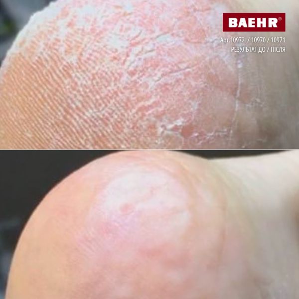 Крем-піна з 10% сечовиною та маслом троянди для ніг 300мл (CREMESCHAUM ROSE), PEDIBAEHR