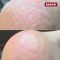 Крем-піна з 10% сечовиною та маслом троянди для ніг 300мл (CREMESCHAUM ROSE), PEDIBAEHR
