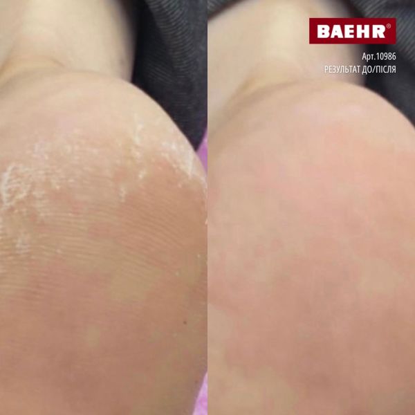 Крем для ніг зі 100%-вим оленячим жиром 125мл (DEER TALLOW CREAM), PEDIBAEHR