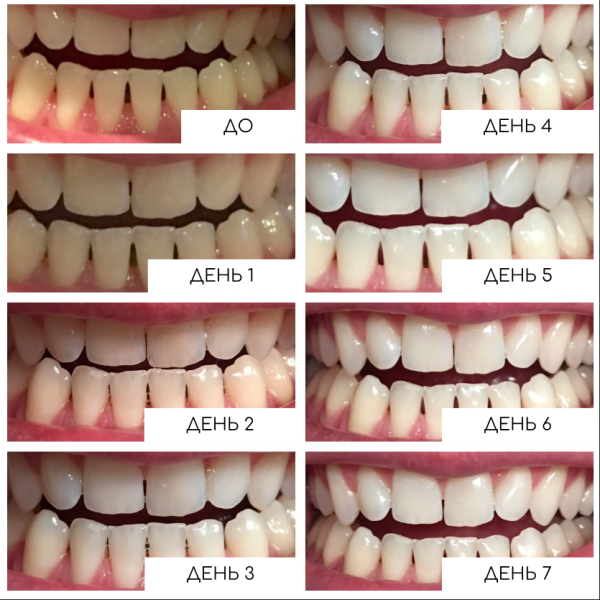 Отбеливающие полоски Medica+ 3DWhite Strips