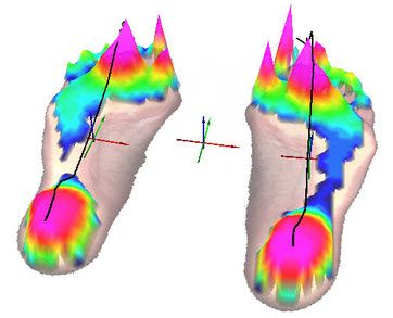 Динамическая дорожка Ped pressure basic()