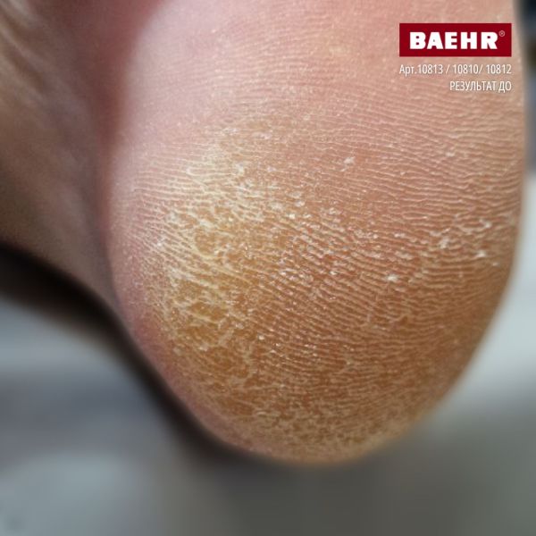 Бальзам з каріте для ніг 75мл (CARE BALSAM), PEDIBAEHR