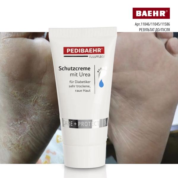 Бальзам із 10% сечовиною для ніг 500мл (SENSITIVE BALM SOFT), PEDIBAEHR
