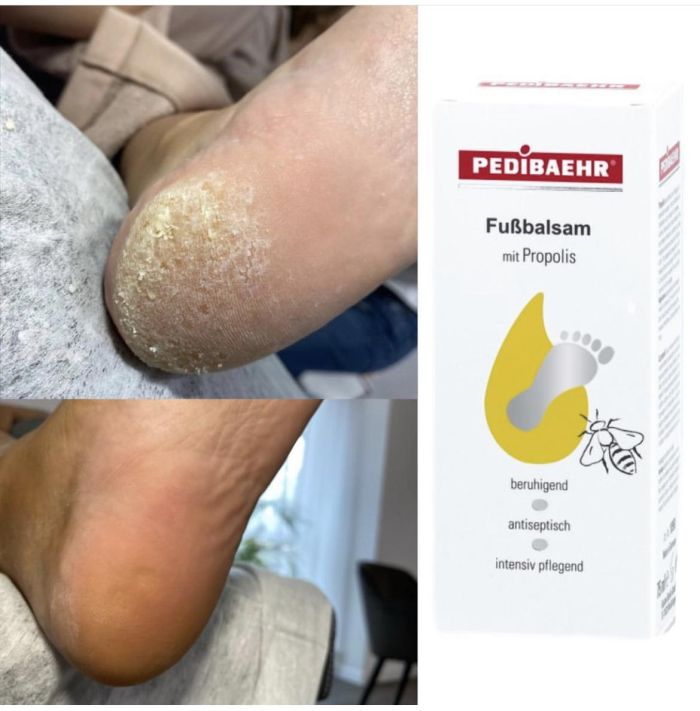 Бальзам з Прополісом FUSSBALSAM MIT PROPOLIS 500 мл + дозатор