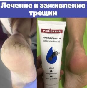 Крем для ніг з натуральним 100% оленячим жиром HIRSCHTALGCREME MIT  LATSCHENKIEFERNÖL 125 мл