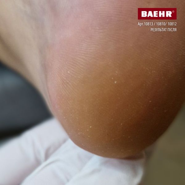 Бальзам з каріте для ніг 75мл (CARE BALSAM), PEDIBAEHR