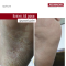 Крем з 10%-ою сечовиною для ніг 125 мл (PROTECTIVE FOOTCREAM), PEDIBAEHR