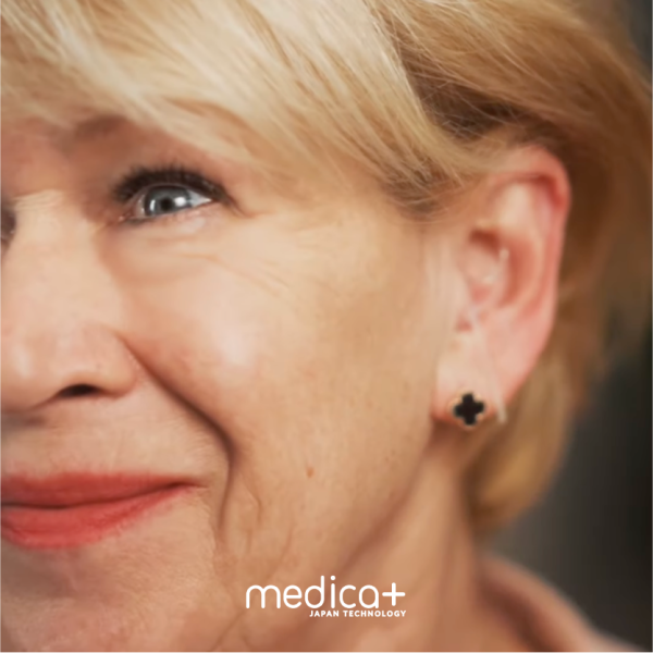 Универсальный слуховой аппарат Medica+ SOUND CONTROL 15